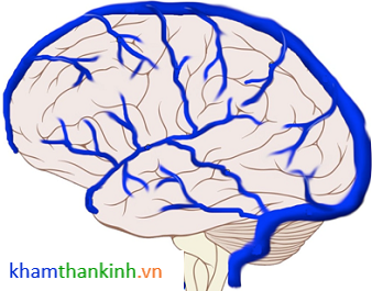 Chảy máu tiểu não ... nguyên nhân do Huyết khối tĩnh mạch não.